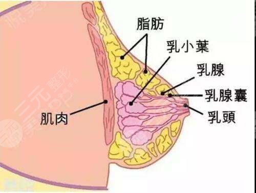 自体脂肪隆胸