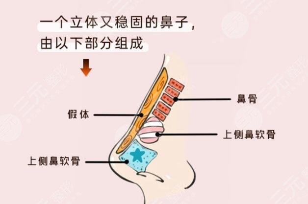 全肋隆鼻手术有哪些特点?