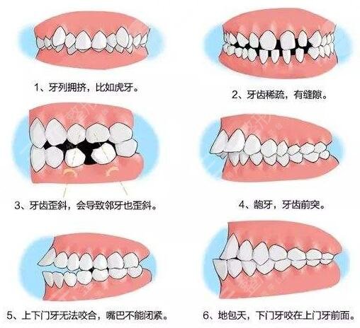 保山昆华医院牙科牙齿矫正果图