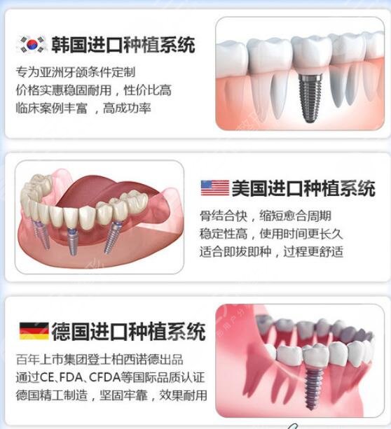 牙齿种植特点都有哪些呢?