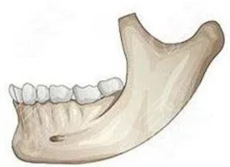 广州星念医疗美容下颌角磨骨后3周