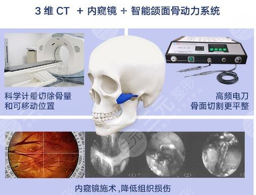 磨骨手术