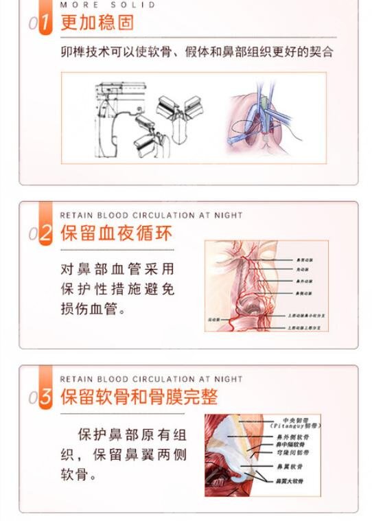 什么是鼻部手术整形?