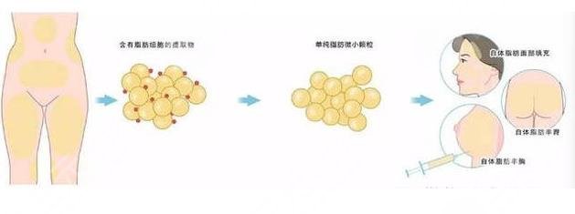 天津薇斯医疗靠谱吗