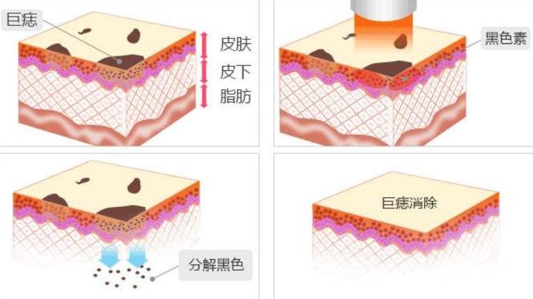 南昌一附院美容科点痣技术好不好？医院简介+口碑~