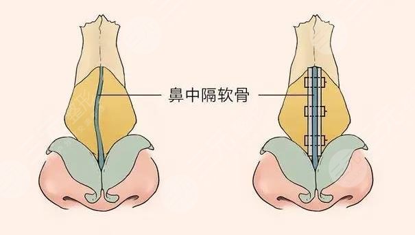 南方医科大学深圳医院美容科擅长科普信息