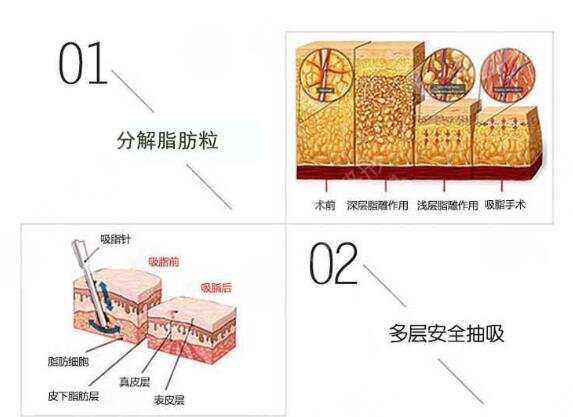 清远人民医院整形美容科案例反馈