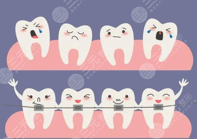 深圳富华口腔热门项目科普