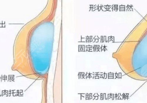 广州荔湾区人民医院做修复鼻子多少钱?