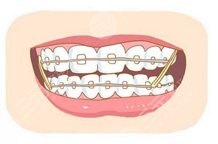 北京世纪坛医院牙齿矫正专家