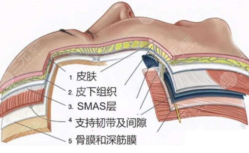 筋膜抗衰