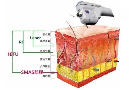 超声炮全模式和双模式区别