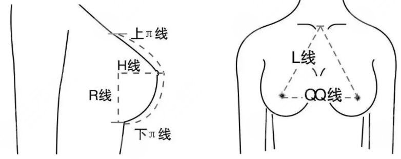 魔滴假体隆胸效果好吗?