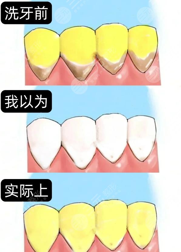 牙齿发黄变白的方法有哪些