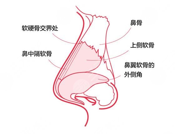 膨体隆鼻需要注意的事项有哪些?