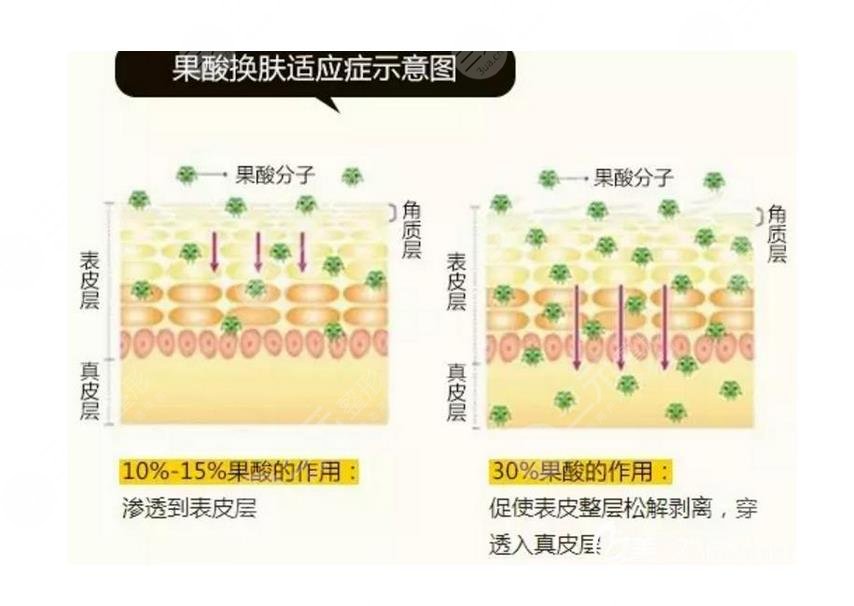 脸上皮肤粗糙毛孔粗大怎么才能恢复得好？