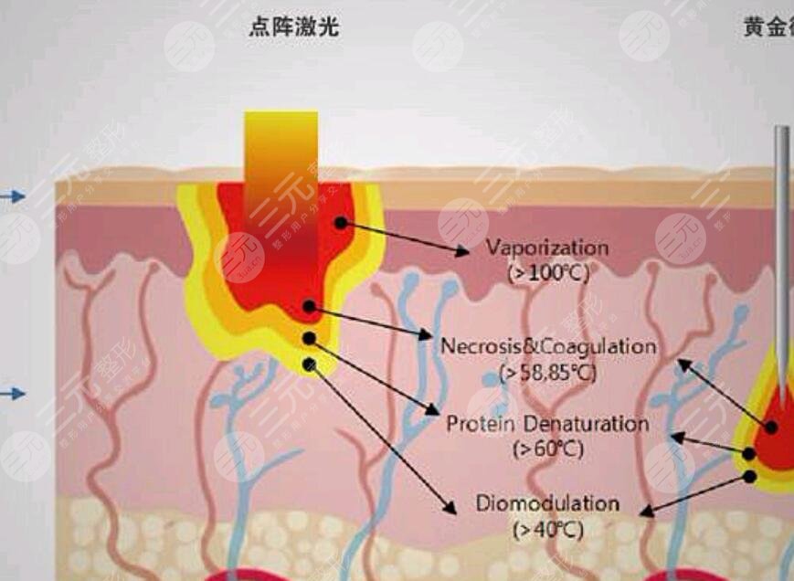 脸上的红血丝是怎样形成的?