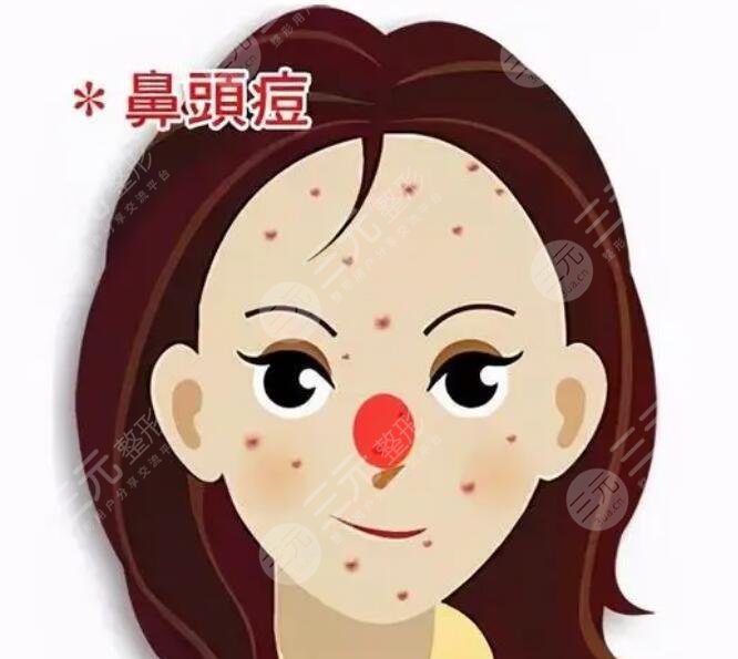 寻求医美治疗：适用于严重痤疮病例