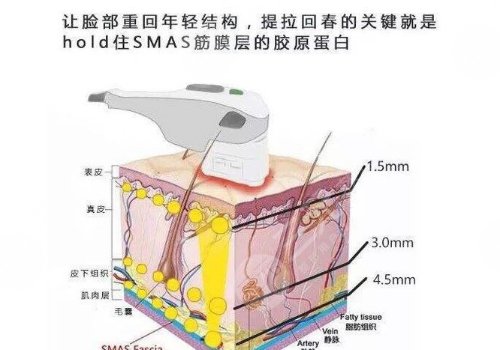 热玛吉有什么效果和副作用？