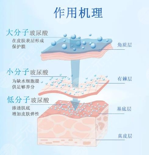 玻尿酸填充泪沟有鼓包怎么处理？