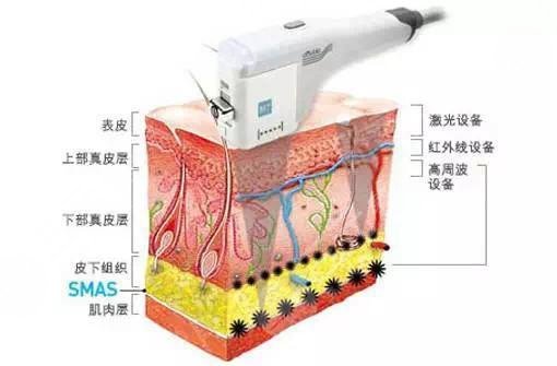 什么是红血丝呢?