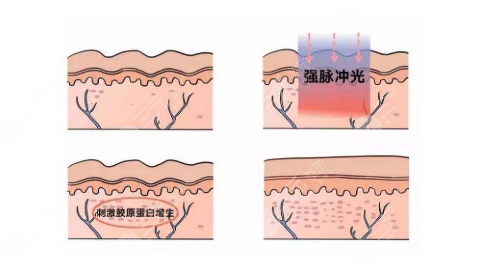 皮肤补水小妙招?get