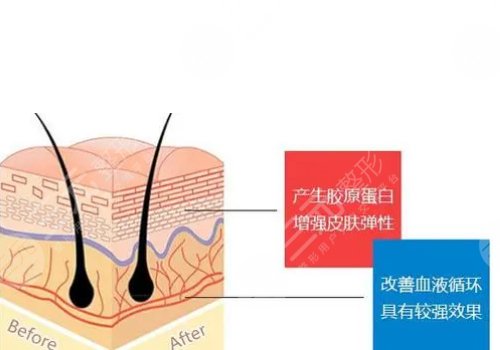 修复型胶原蛋白acmetea多少钱?