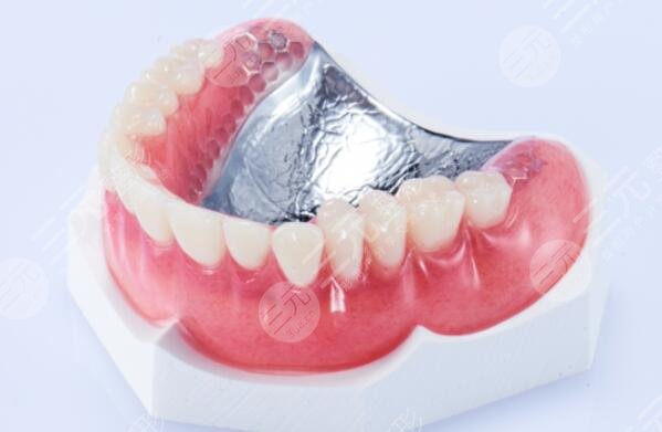 钛合金义齿有什么优点?相关科普一览!