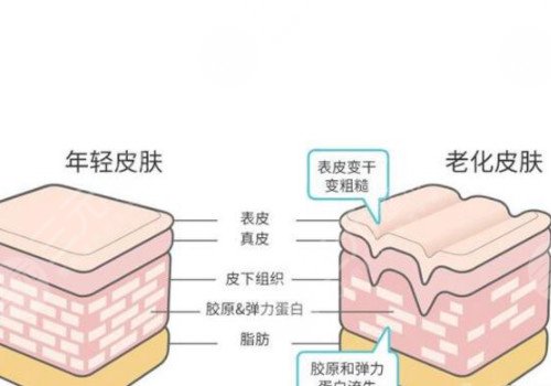 脸上皱纹怎么去除?