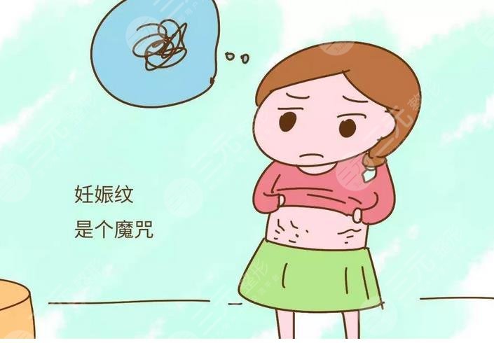 如何消除妊娠纹?