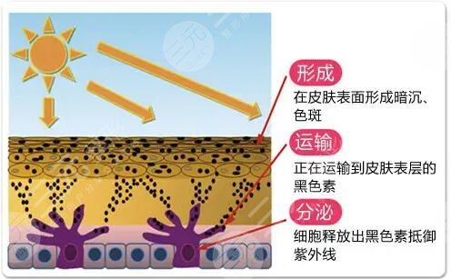 激光美白的价格是多少?