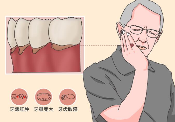 牙龈萎缩的治疗方法有哪些？牙龈萎缩了怎么办？别慌！