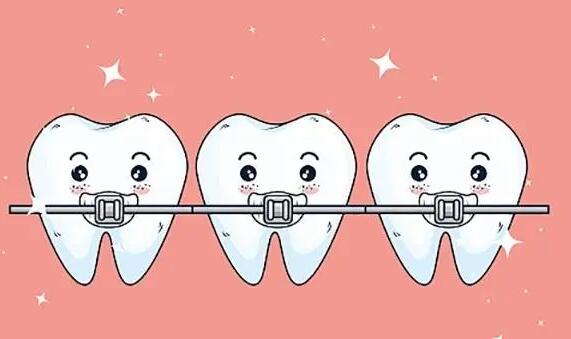 T4K早期牙畸形矫正装置介绍