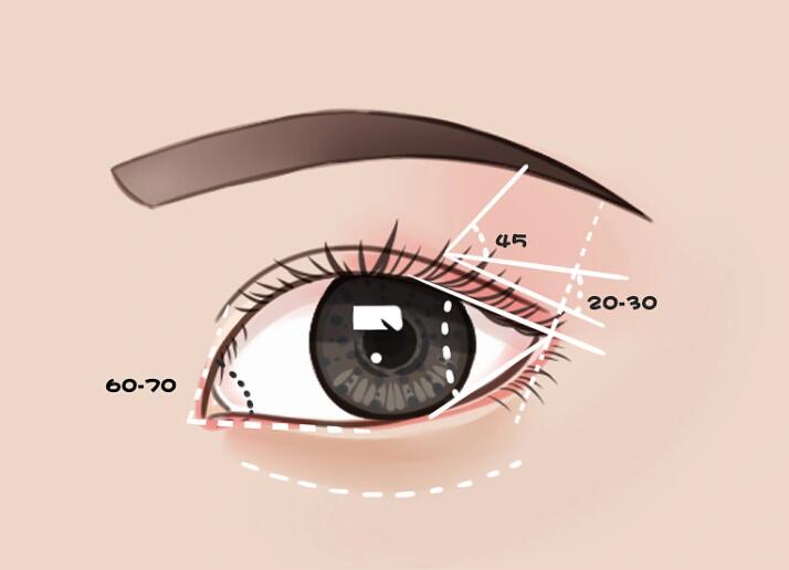上海九院整形科双眼皮案例分享